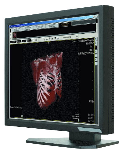 Ecran m�dical 21.3" LCD : ONYX-2421 -> AAEON