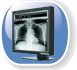Ecran m�dical monochrome
