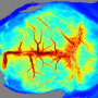 Système d'imagerie par contraste speckle laser : RFLSI-ZW