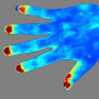 Système d'imagerie par contraste speckle laser : RFLSI-ZW