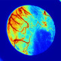 Système d'imagerie par contraste speckle laser : RFLSI-ZW