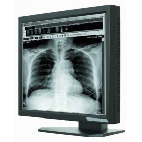 Ecran LCD Médical 21.3" : ONYX-2321