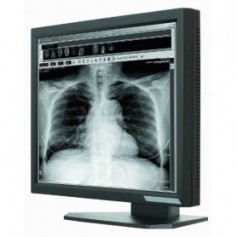 Ecran LCD Médical 21.3" : ONYX-2321