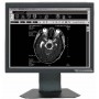 Ecran LCD Médical 19" : ONYX-2319