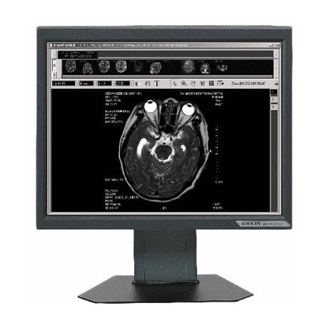 Ecran LCD Médical 19" : ONYX-2319
