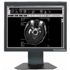 Ecran LCD Médical 19" : ONYX-2319