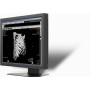 Ecran LCD Médical 19": ONYX-2419