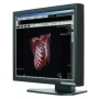 Ecran médical 21.3" LCD : ONYX-2421