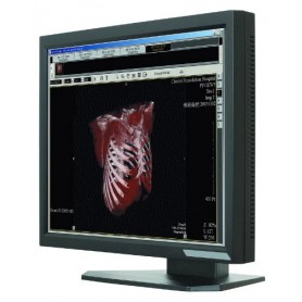 Ecran médical 21.3" LCD : ONYX-2421