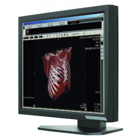 Ecran médical 21.3" LCD : ONYX-2421